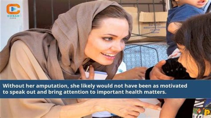 Angelina Jolie's Leg Amputation Rumors Debunked