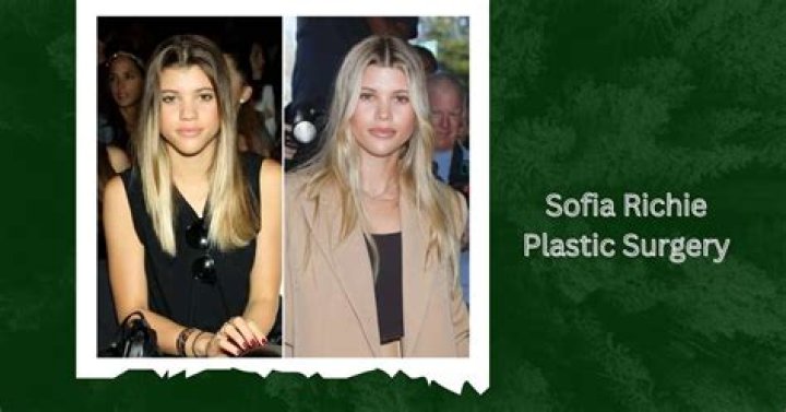 Uncovering The Secrets Of Sofia Richie's Plastic Surgery Journey